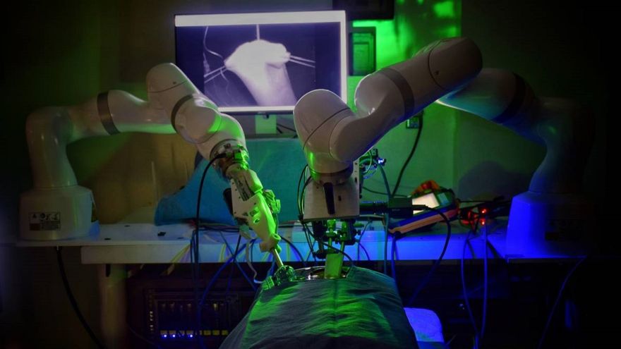 The first robotic surgery was performed without human assistance