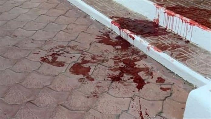 British tourist assaulted and stabbed on Ibiza British tourist assaulted and stabbed on Ibiza