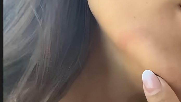 A famous singer, stung by jellyfish in Ibiza: “A pain I had never felt in my life”