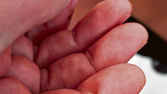 88b5275e-83ec-4db1-bb49-0bd6294e07c3_16-9-aspect-ratio_default_0.jpg Tamara, patient from Ibiza: “I have been waiting a month and a half for Traumatology to remove a cactus spike that is piercing my finger”