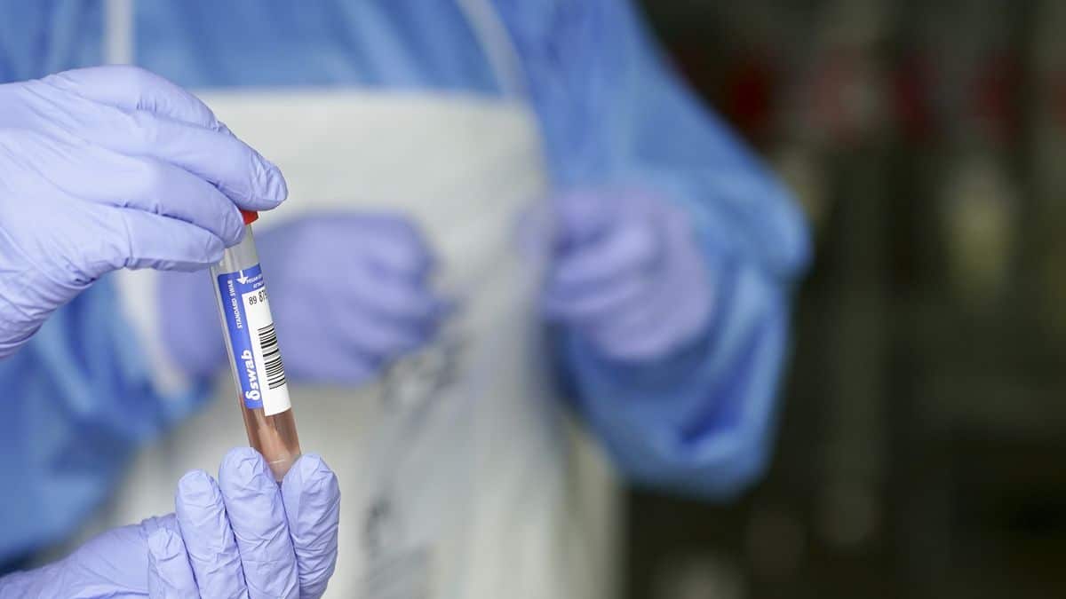 The finding of what may be the initial symptom of people infected with the Omicron variant